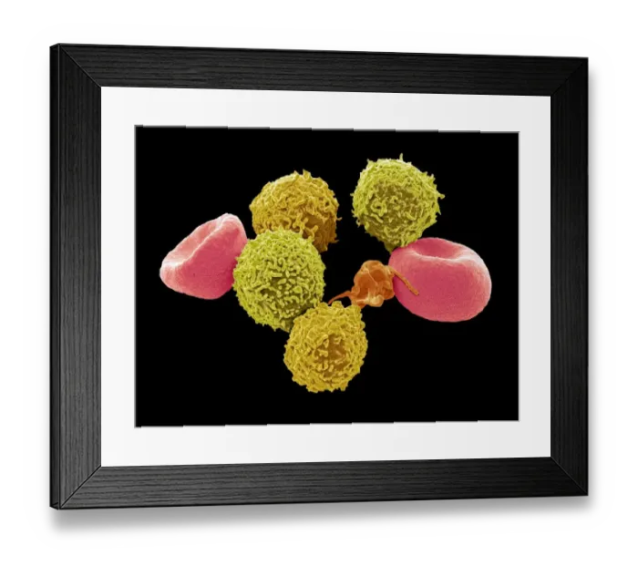 Framed Print : Blood cells, SEM Framed Print : Blood cells, SEM