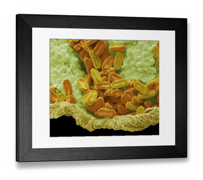 Framed Print : Verbena pollen, SEM Framed Print : Verbena pollen, SEM