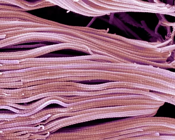 Collagen, Scanning electron micrograph (SEM)