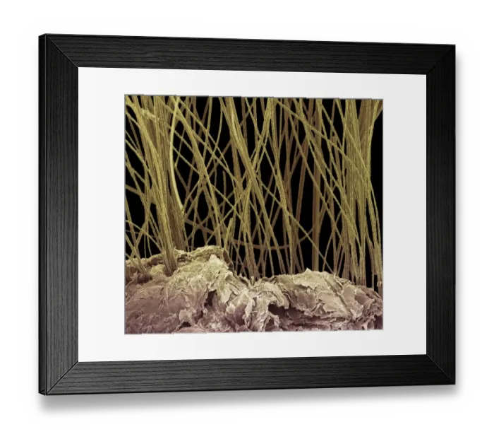 Framed Print : Dog hair, colored scanning electron micrograph (SEM) Framed Print : Dog hair, colored scanning electron micrograph (SEM)