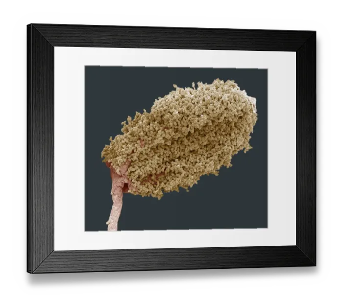 Framed Print : Wood anemone anther, SEM Framed Print : Wood anemone anther, SEM
