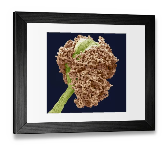 Framed Print : Bay tree anther, SEM Framed Print : Bay tree anther, SEM