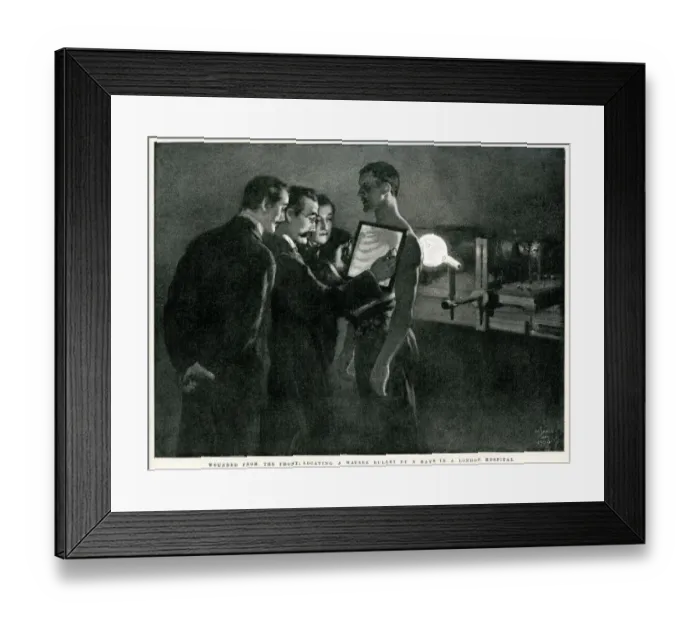 Framed Print : X-Rays of a Wounded Solider Framed Print : X-Rays of a Wounded Solider