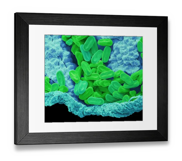 Framed Print : Verbena pollen, SEM Framed Print : Verbena pollen, SEM