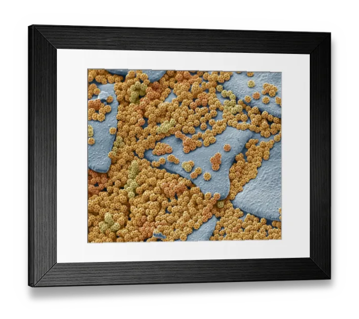 Framed Print : Brochosomes, SEM Framed Print : Brochosomes, SEM