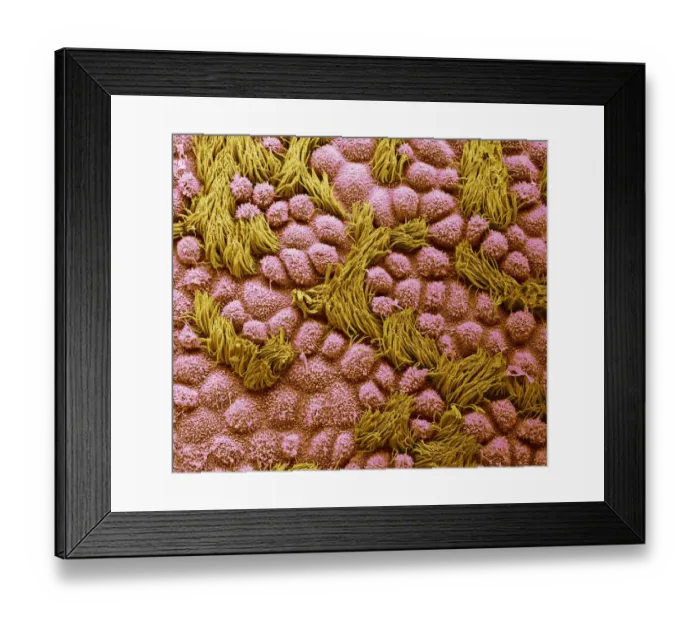 Framed Print : Fallopian tube, SEM Framed Print : Fallopian tube, SEM