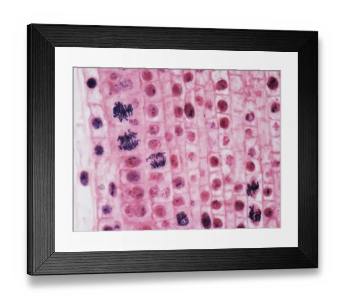 Framed Print : Mitosis, LM Framed Print : Mitosis, LM