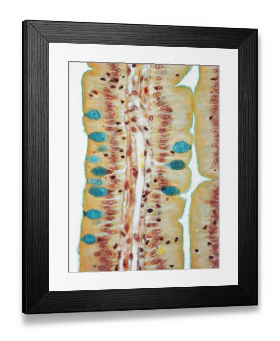 Framed Print : Small intestine, LM Framed Print : Small intestine, LM
