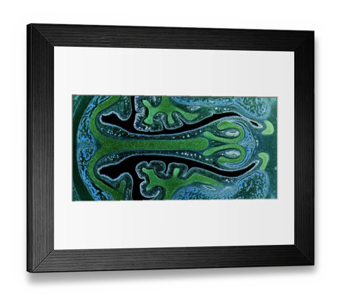 Framed Print : Nasal sinuses, LM Framed Print : Nasal sinuses, LM