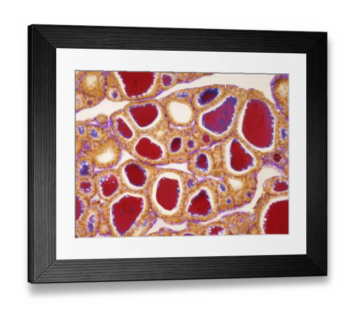 Framed Print : Thyroid, LM Framed Print : Thyroid, LM