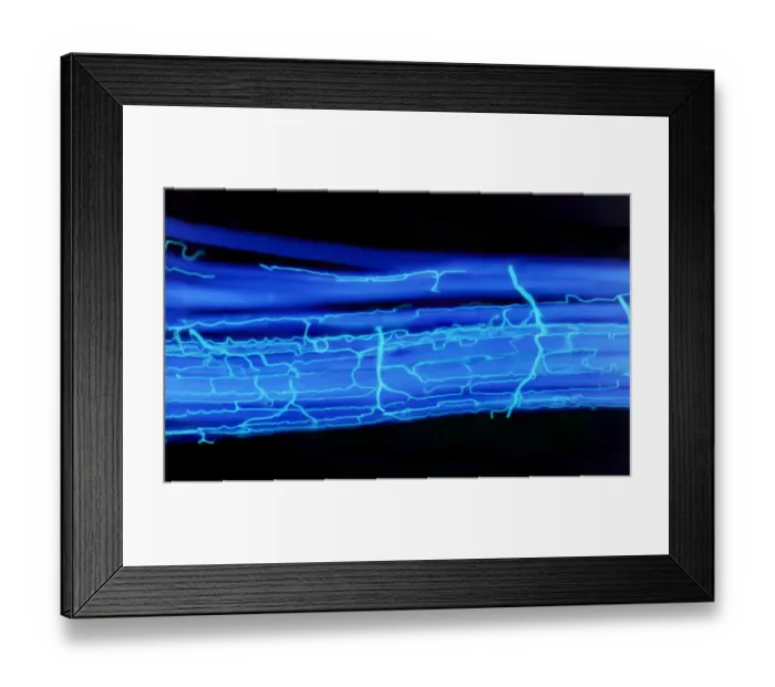 Framed Print : Blood supply to muscles, LM
