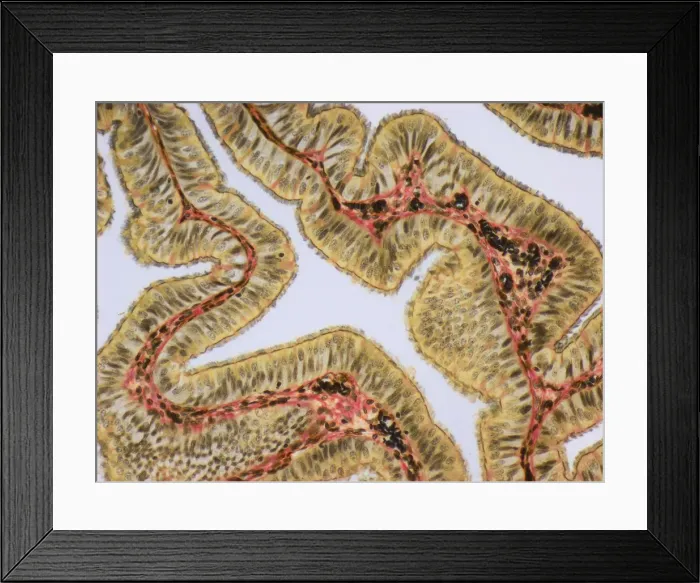 Framed Print : Fallopia tube, LM Framed Print : Fallopia tube, LM