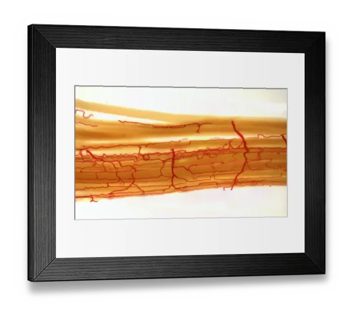 Framed Print : Blood supply to muscles, LM Framed Print : Blood supply to muscles, LM