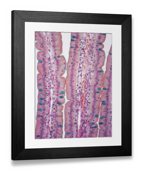 Framed Print : Small intestine, LM Framed Print : Small intestine, LM