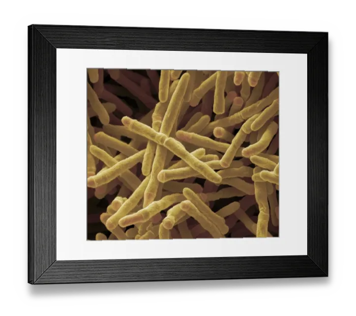 Framed Print : Mycobacterium smegmatis bacteria, SEM Framed Print : Mycobacterium smegmatis bacteria, SEM
