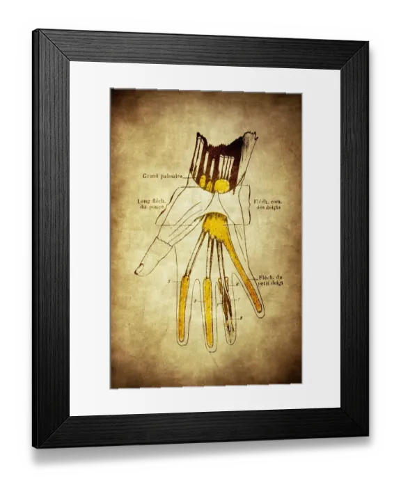 Framed Print : Synovial sheaths of wrist, palm and fingers Framed Print : Synovial sheaths of wrist, palm and fingers