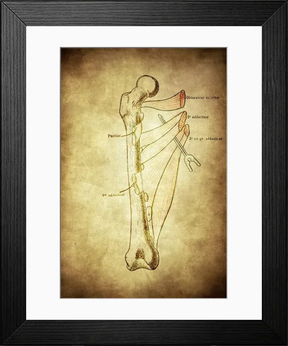 Framed Print : Right femur seen from forward with his adductor muscles Framed Print : Right femur seen from forward with his adductor muscles