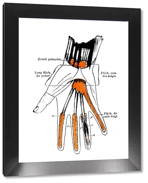 Synovial sheaths of wrist, palm and fingers