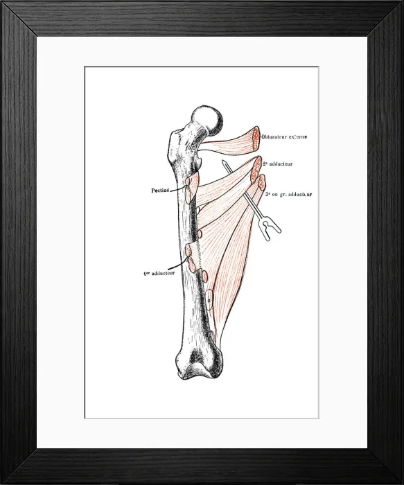 Framed Print : Right femur seen from forward with his adductor muscles Framed Print : Right femur seen from forward with his adductor muscles