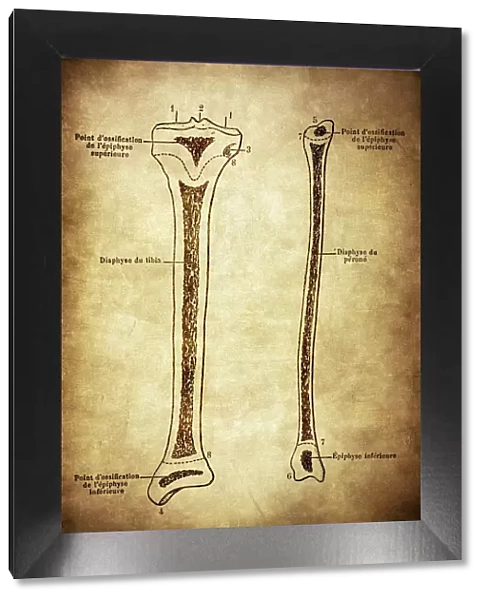 Ossification of the tibia and fibula (leg bone)