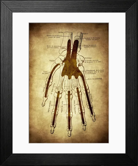 Framed Print : The skeleton of the hand with muscle insertions and tetives, ligaments Framed Print : The skeleton of the hand with muscle insertions and tetives, ligaments