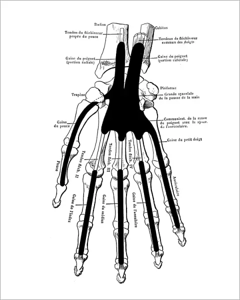 The skeleton of the hand with muscle insertions and tetives, ligaments