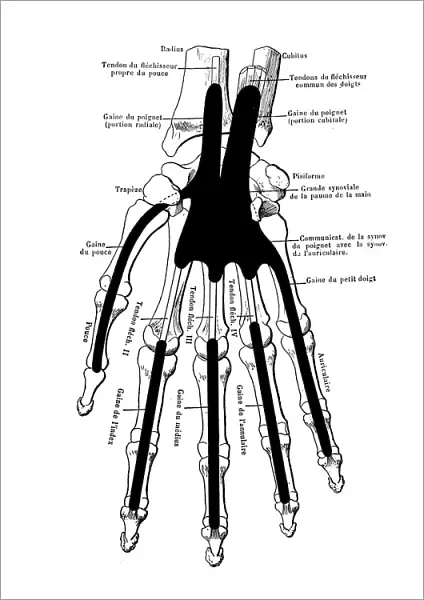 The skeleton of the hand with muscle insertions and tetives, ligaments
