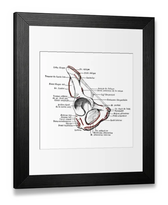 Framed Print : Iliac bone Framed Print : Iliac bone