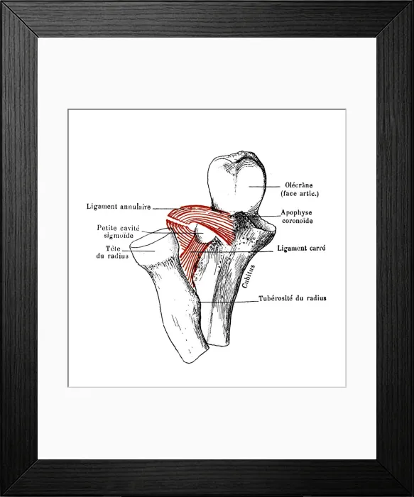 Framed Print : Superior radio-ulnar articulation Framed Print : Superior radio-ulnar articulation