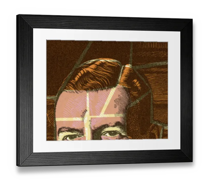 Framed Print : Top of Mans Head Framed Print : Top of Mans Head