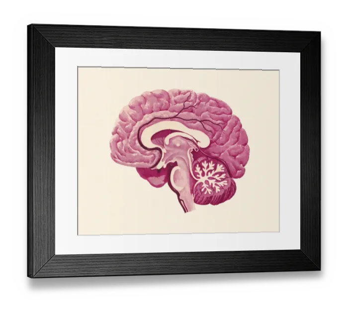 Framed Print : Cross Section of a Brain Framed Print : Cross Section of a Brain