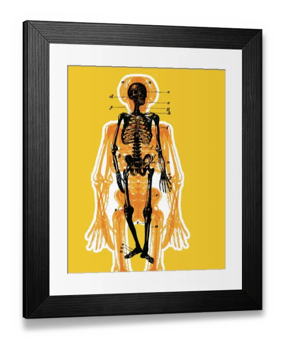 Framed Print : Skeleton. http: / / csaimages.com / images / istockprofile / csa_vector_dsp.jpg Framed Print : Skeleton. http: / / csaimages.com / images / istockprofile / csa_vector_dsp.jpg