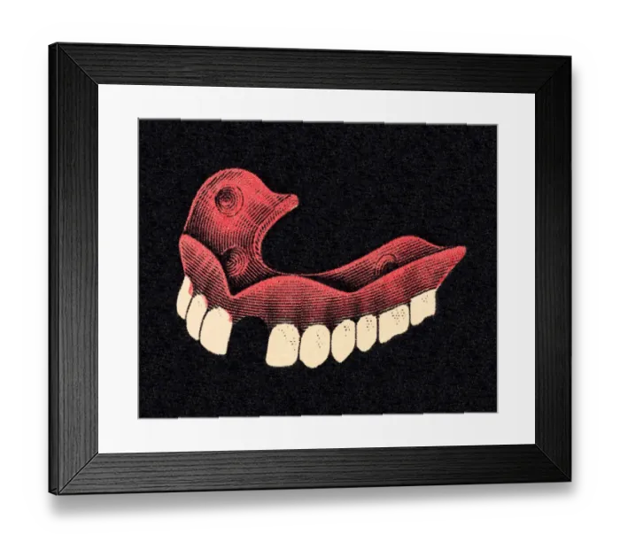 Framed Print : Dentures With Missing Tooth Framed Print : Dentures With Missing Tooth