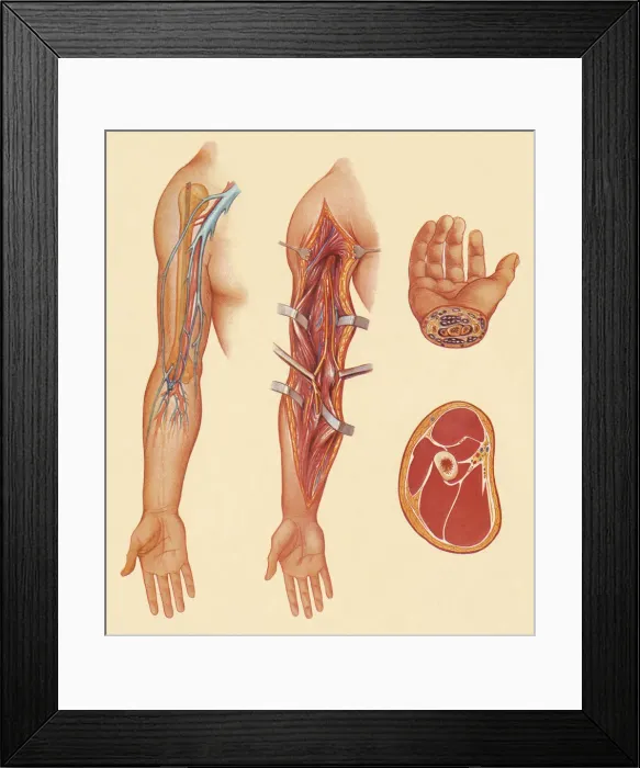 Framed Print : Arm. Hand and Meat Illustration Framed Print : Arm. Hand and Meat Illustration