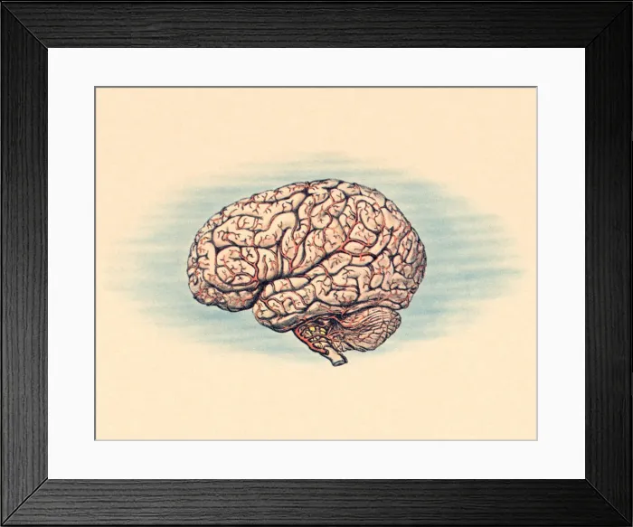 Framed Print : Human Brain Framed Print : Human Brain