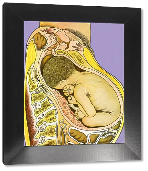Baby Inside Womb