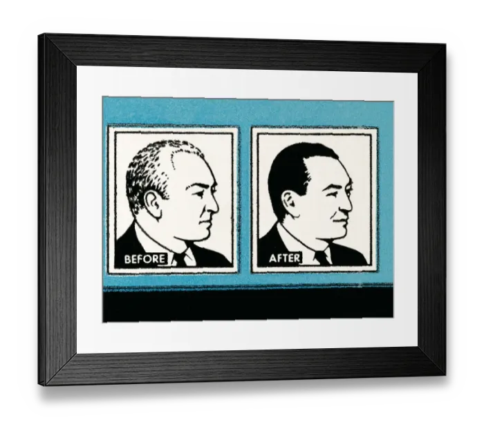 Framed Print : Before and After hair solution