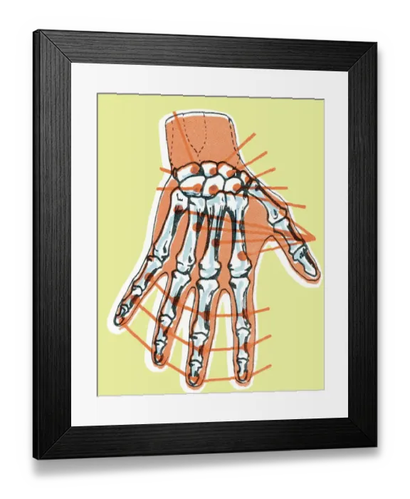 Framed Print : Hand skeleton Framed Print : Hand skeleton