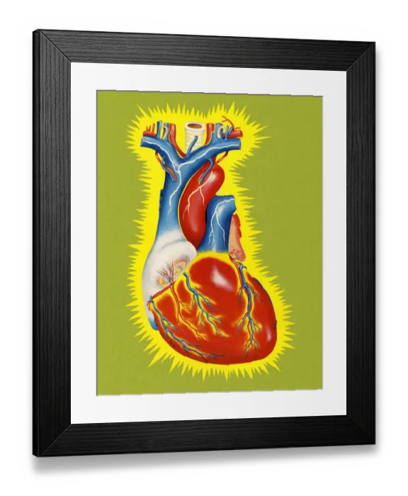 Framed Print : Human Heart Framed Print : Human Heart