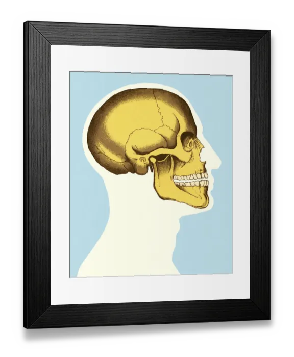 Framed Print : Sideview of Head and Skull Framed Print : Sideview of Head and Skull