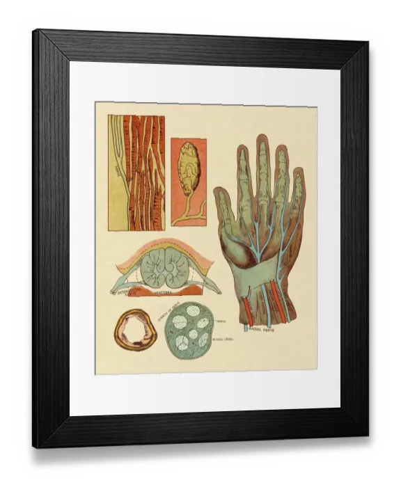 Framed Print : Diagram of Hand Nerves and Arteries Framed Print : Diagram of Hand Nerves and Arteries