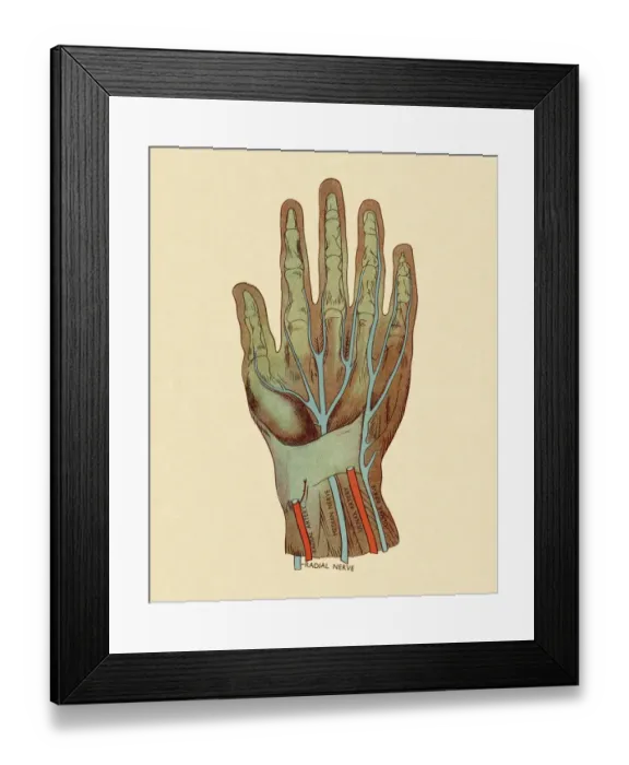 Framed Print : Nerves and Arteries of Hand Framed Print : Nerves and Arteries of Hand