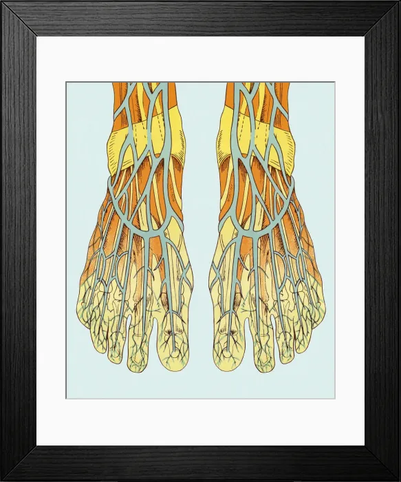 Framed Print : Blood Vessels in Foot Framed Print : Blood Vessels in Foot