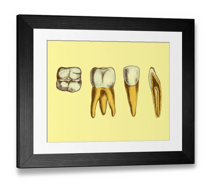 Framed Print : Four Views of Teeth Framed Print : Four Views of Teeth