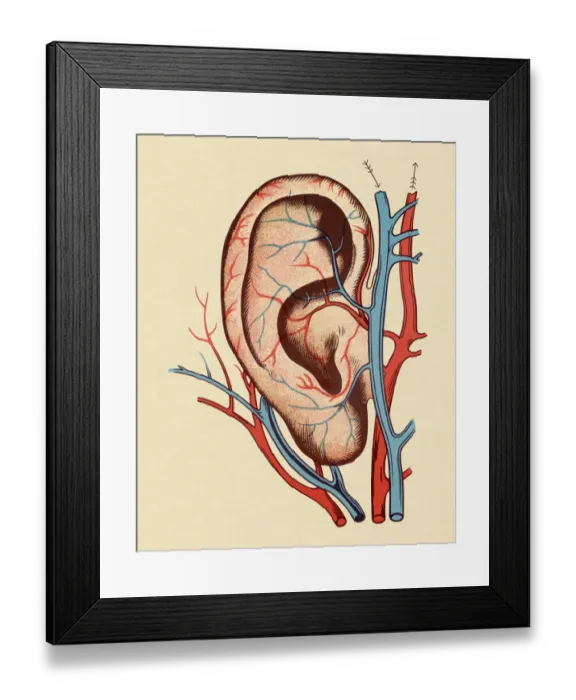 Framed Print : Ear With Blood Vessels Framed Print : Ear With Blood Vessels