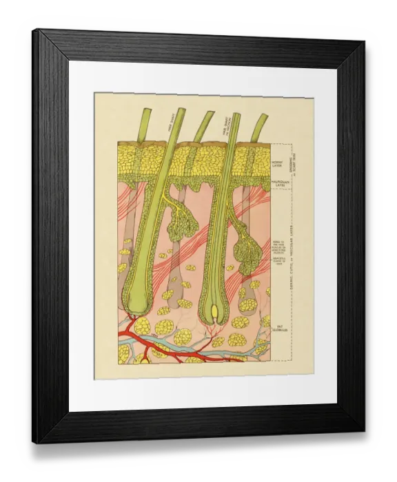 Framed Print : Cross Section of Skin With Hair Follicles Framed Print : Cross Section of Skin With Hair Follicles
