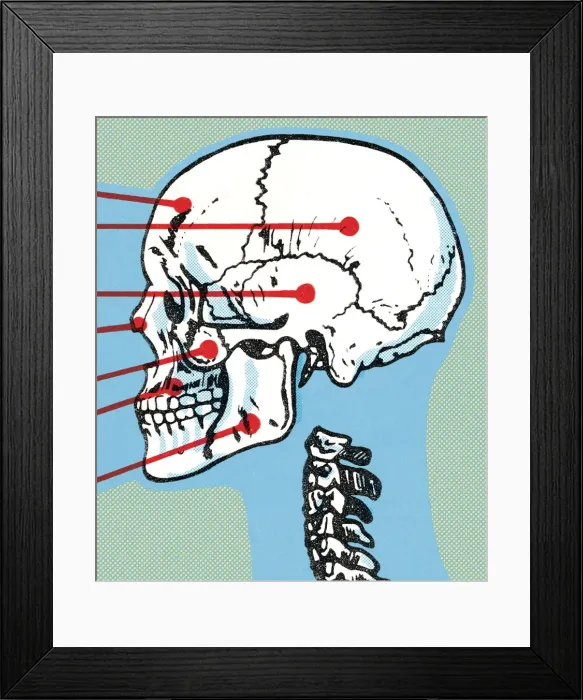 Framed Print : Skull and spine