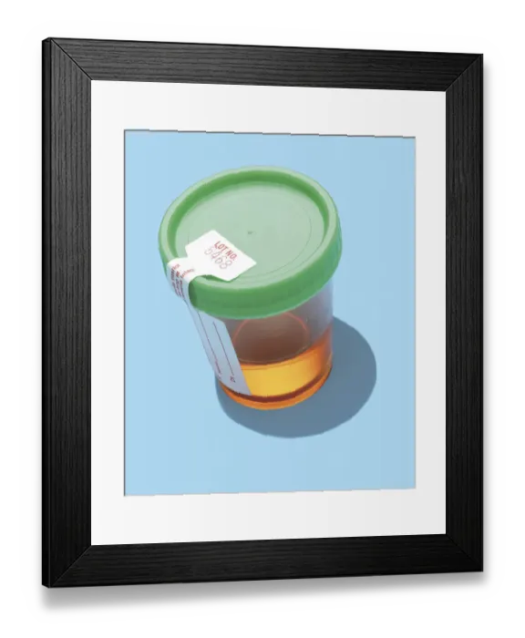 Framed Print : Urine Sample Framed Print : Urine Sample