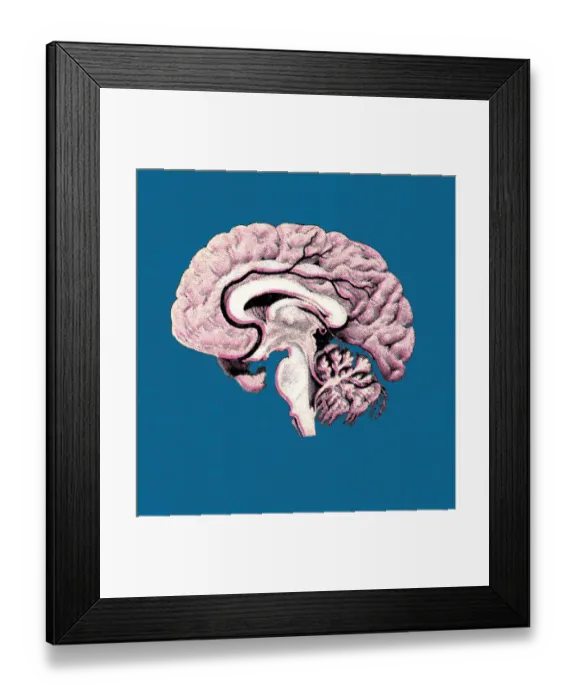 Framed Print : Human Brain