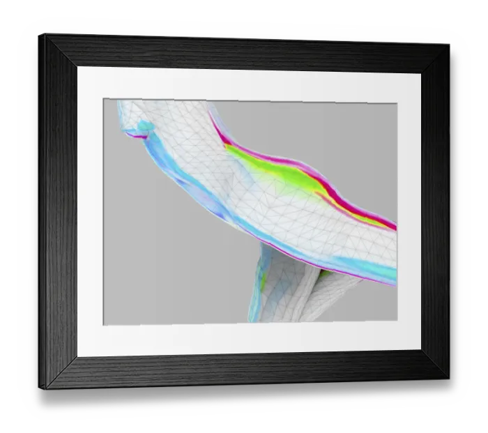 Framed Print : Female body, illustration Framed Print : Female body, illustration